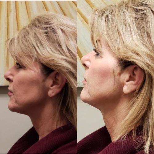 Texture and glow results